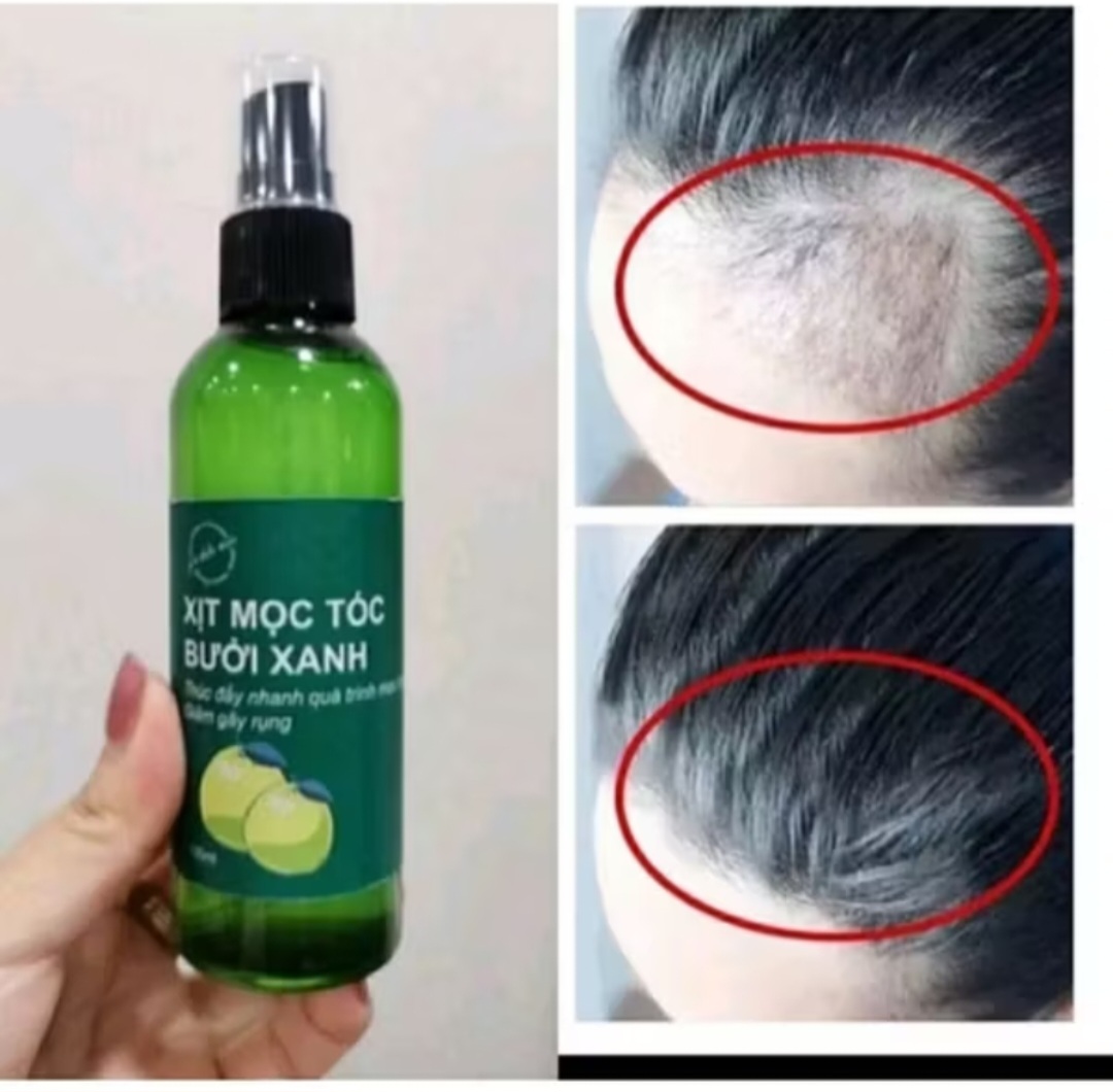 CHAI TINH DẦU BƯỞI XỊT KÍCH THÍCH MỘC TÓC CAO CẤP HÀNG CHUẨN CHẤT LƯỢNG