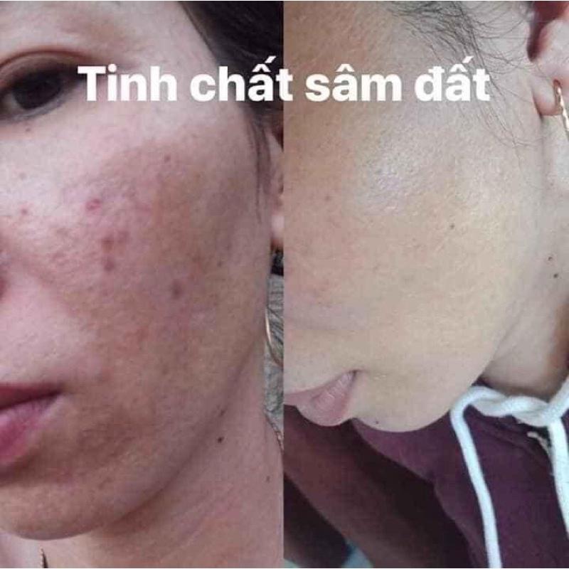 Tinh Chất Sâm Đất DR CELL 50ml