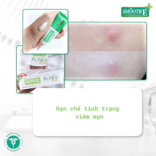 Smooth E VN - Kem ngăn ngừa mụn Acne HydroGel Plus 4%