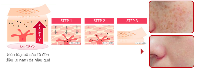 Sản phẩm giúp loại bỏ vết sạm, nám dưỡng trắng và làm đều màu da từ bên trong