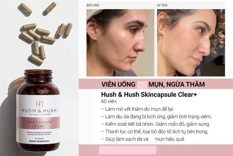 Viên Uống Giảm Mụn Image Skincare Hush & Hush SkinCapsule Clear+ 60viên