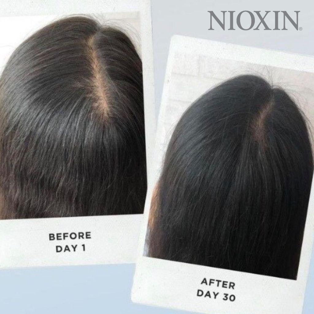 Bộ Chăm Sóc Tóc NIOXIN 3 Bộ Chăm Sóc Tóc Dành Cho Tóc Nhuộm, Thưa Mỏng Và Rụng Nhẹ