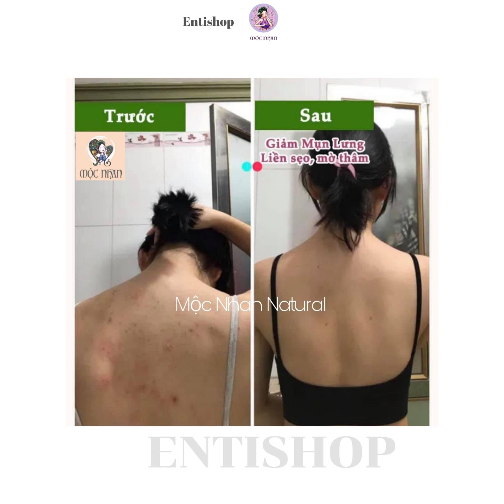 Xà bông Mướp đắng tràm trà giảm mụn lưng, viêm lỗ chân lông MỘC NHAN 100gr