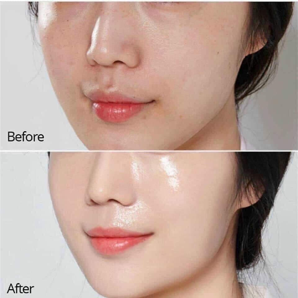 Kem Trẻ Hoá Phục Hồi Retinol x5 mờ nám tàn nhang thâm mụn hết nếp nhăn săn chắc da nâng cơ mặt chống chảy xệ.