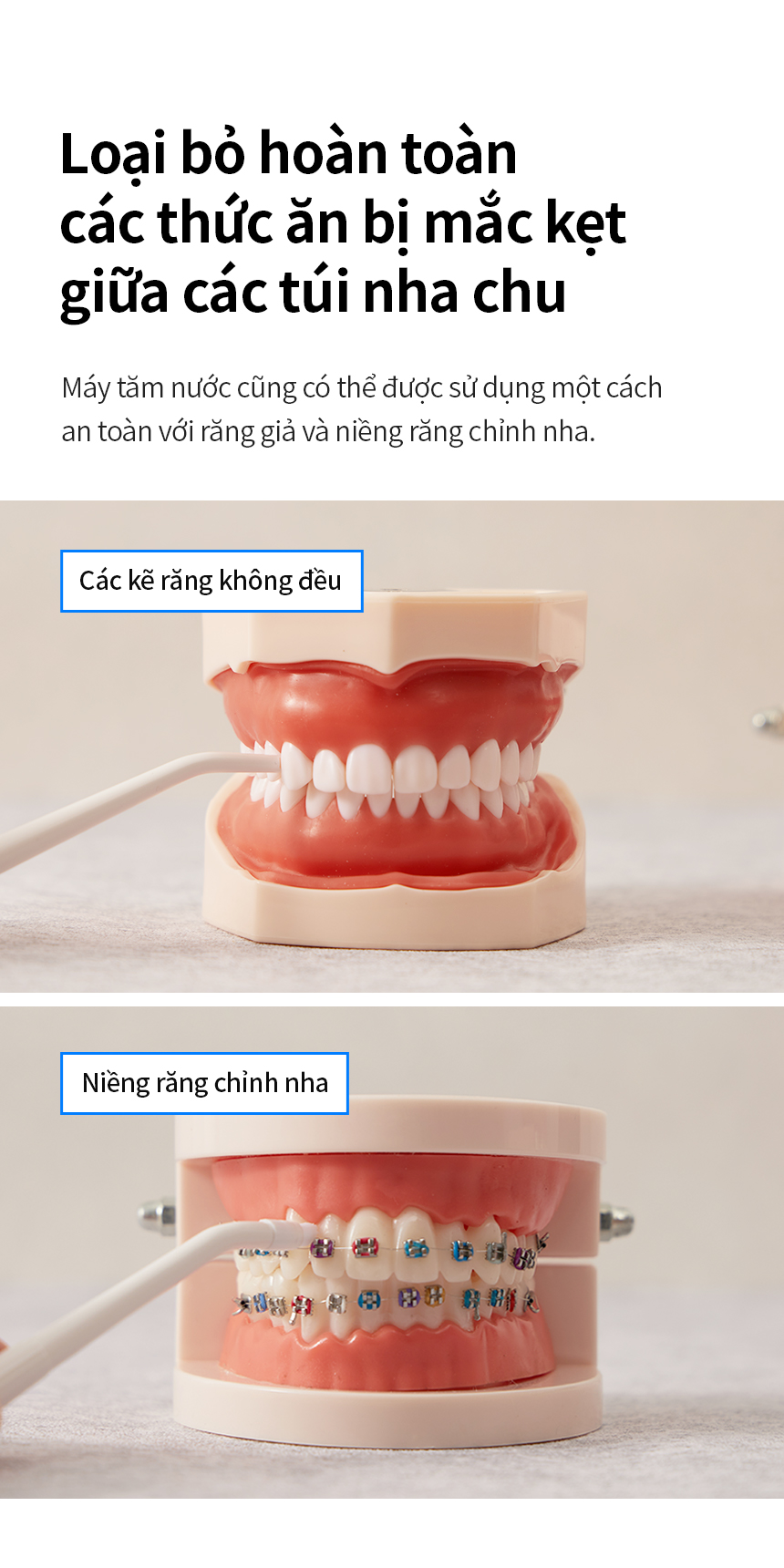 Bộ 4 đầu tăm nước thay thế LocknLock ENR146WHT_RB, Hàng chính hãng, dùng cho máy tăm nước ENR146WHT - JoyMall