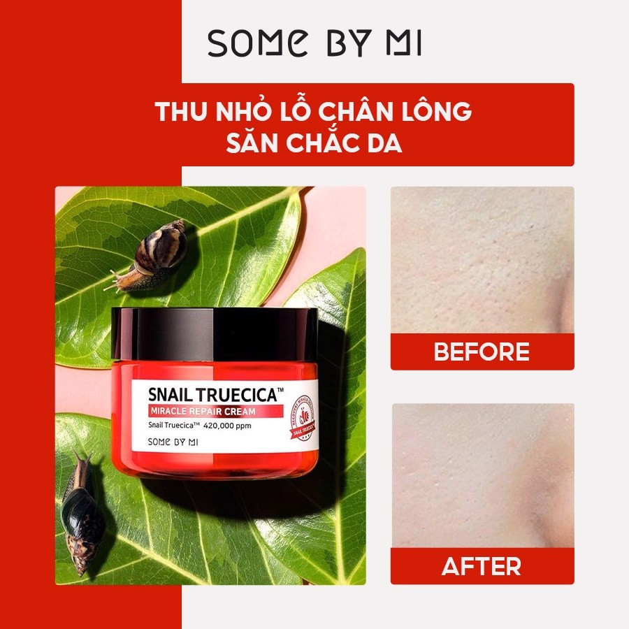 Bộ Sản Phẩm Dưỡng Da Phục Hồi Some By Mi Snail Truecica Miracle Repair