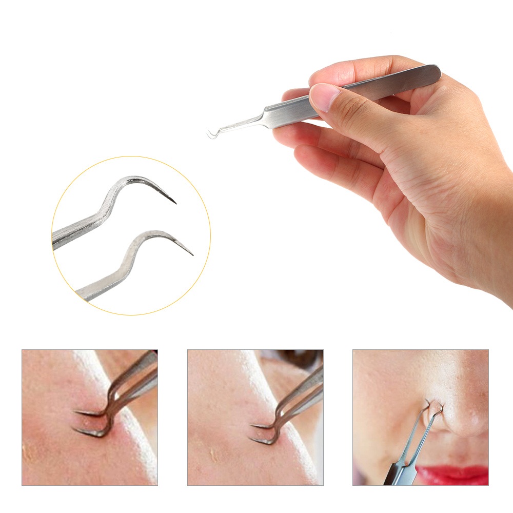 Nhíp gắp mụn Vacosi T07 Blackhead Tweezer