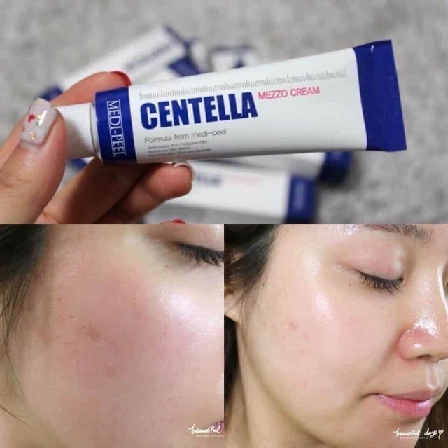 Kem Dưỡng Phục Hồi Chuyên Sâu Cho Da Mụn Medi-Peel Centella Mezzo Cream 30ml - Hàn Quốc