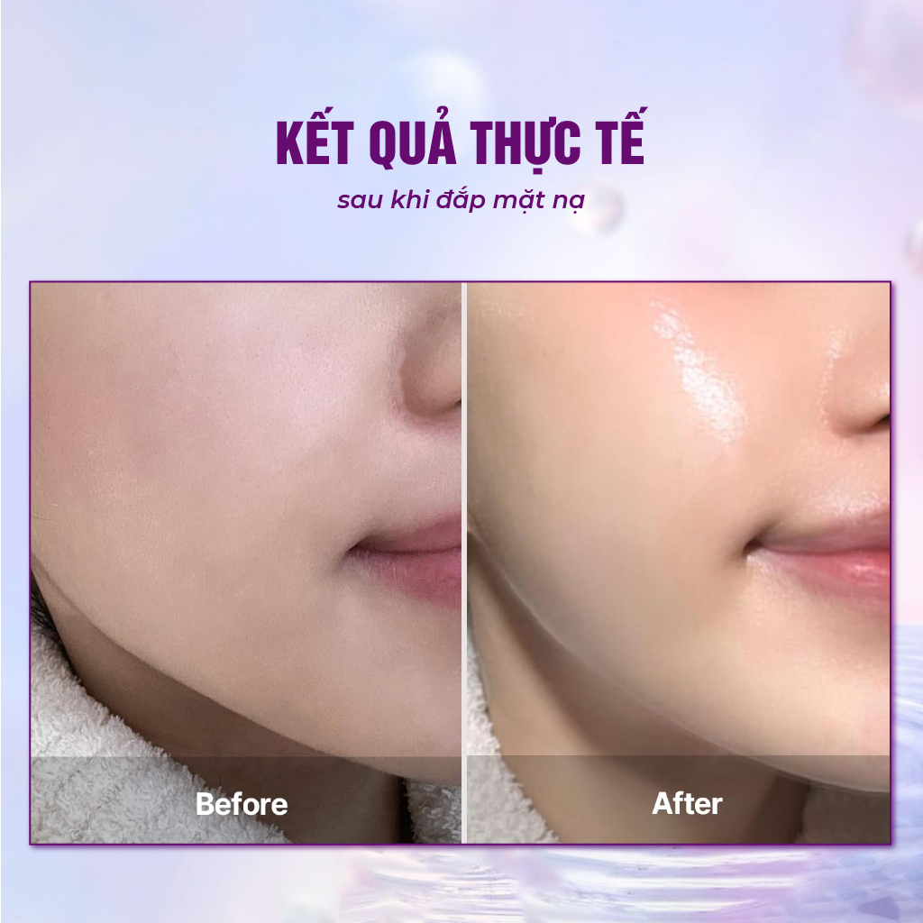 Mặt nạ BESKINATY Glutathione Bio Mask dưỡng sáng phục hồi da cao cấp Hàn Quốc