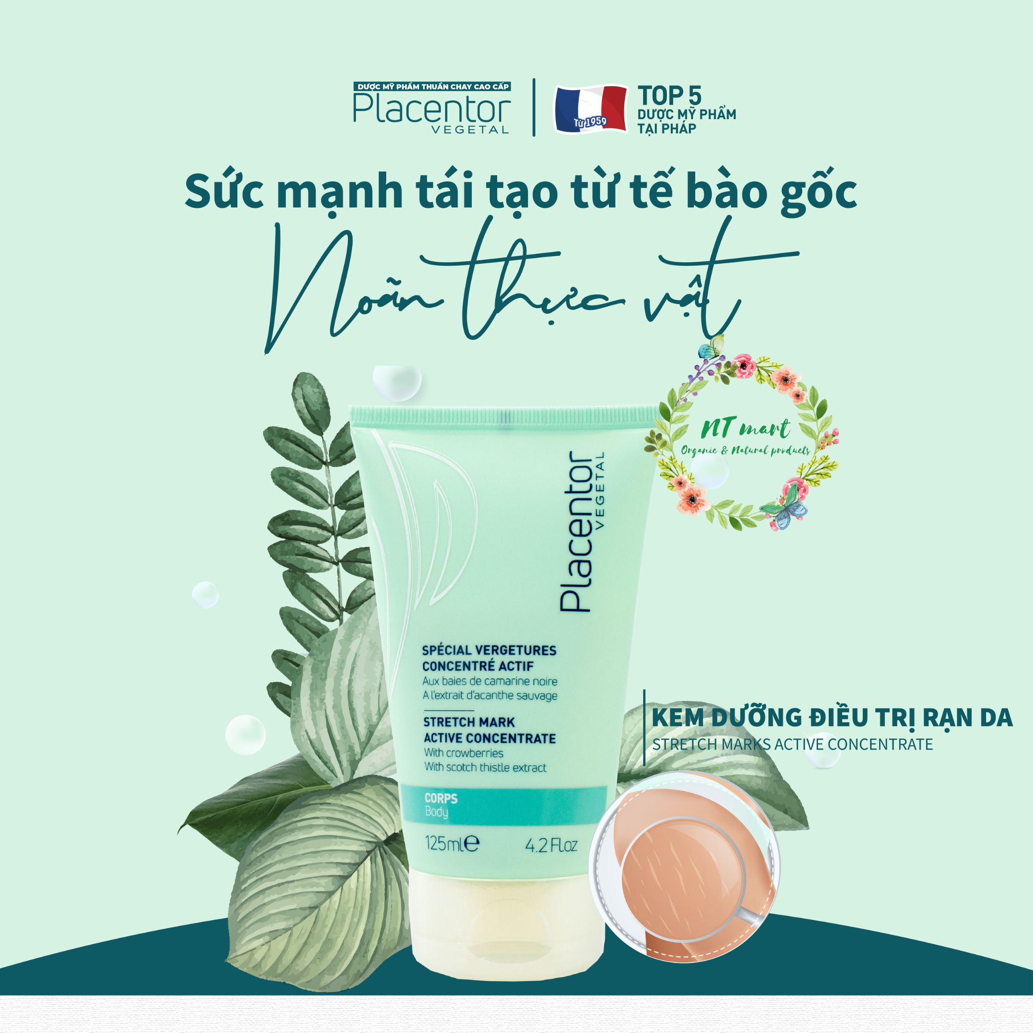 [THUẦN CHAY] Kem Dưỡng Rạn Da Placentor Stretch Marks Active Concentrate