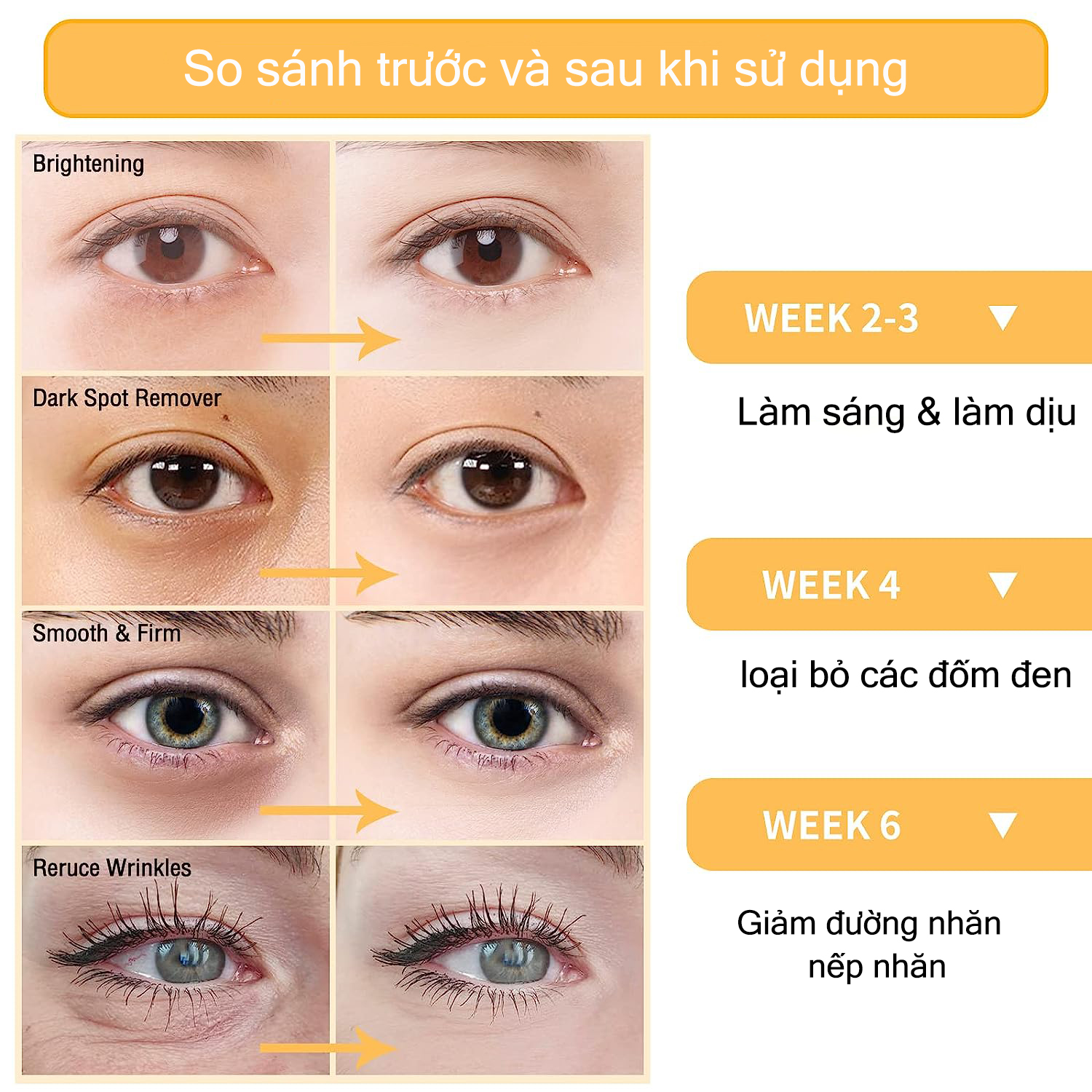 Serum Vitamin C BSKM Giảm Nếp Nhăn Cải Thiện Da Mặt Serum Làm Trắng Da Chống Lão Hóa Mỹ Phẩm 28Ml