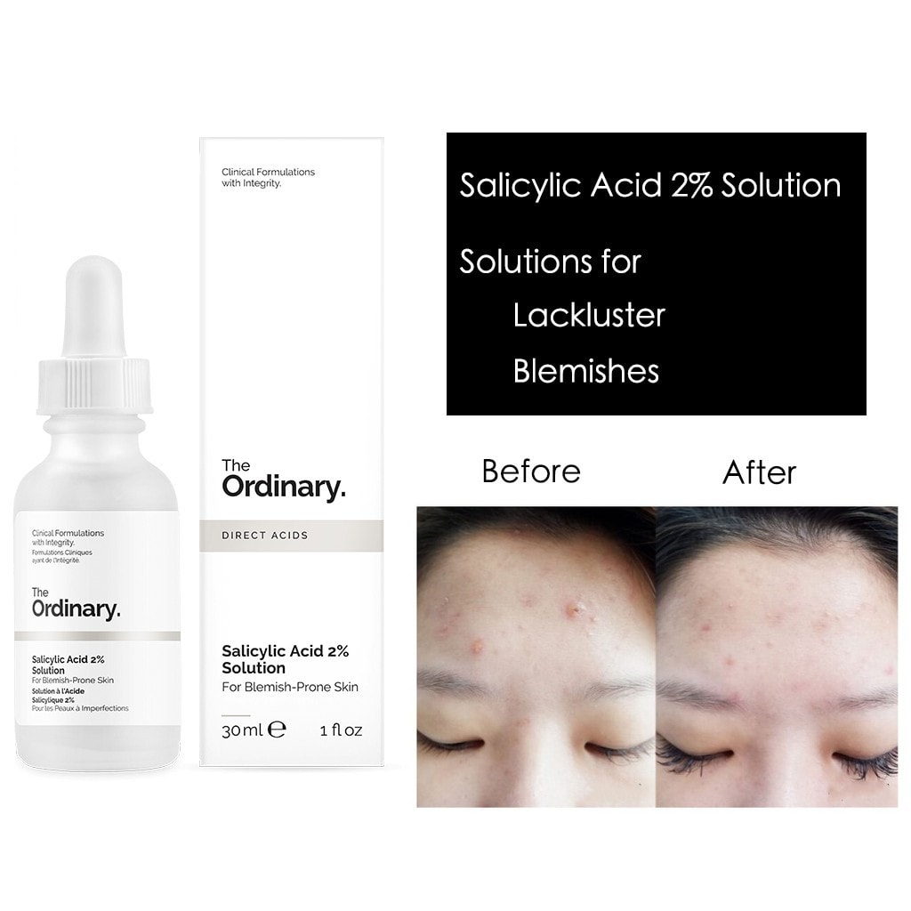 Tinh Chất Tẩy Tế Bào Chết The Ordinary Salicylic Acid 2% Solution 30ml