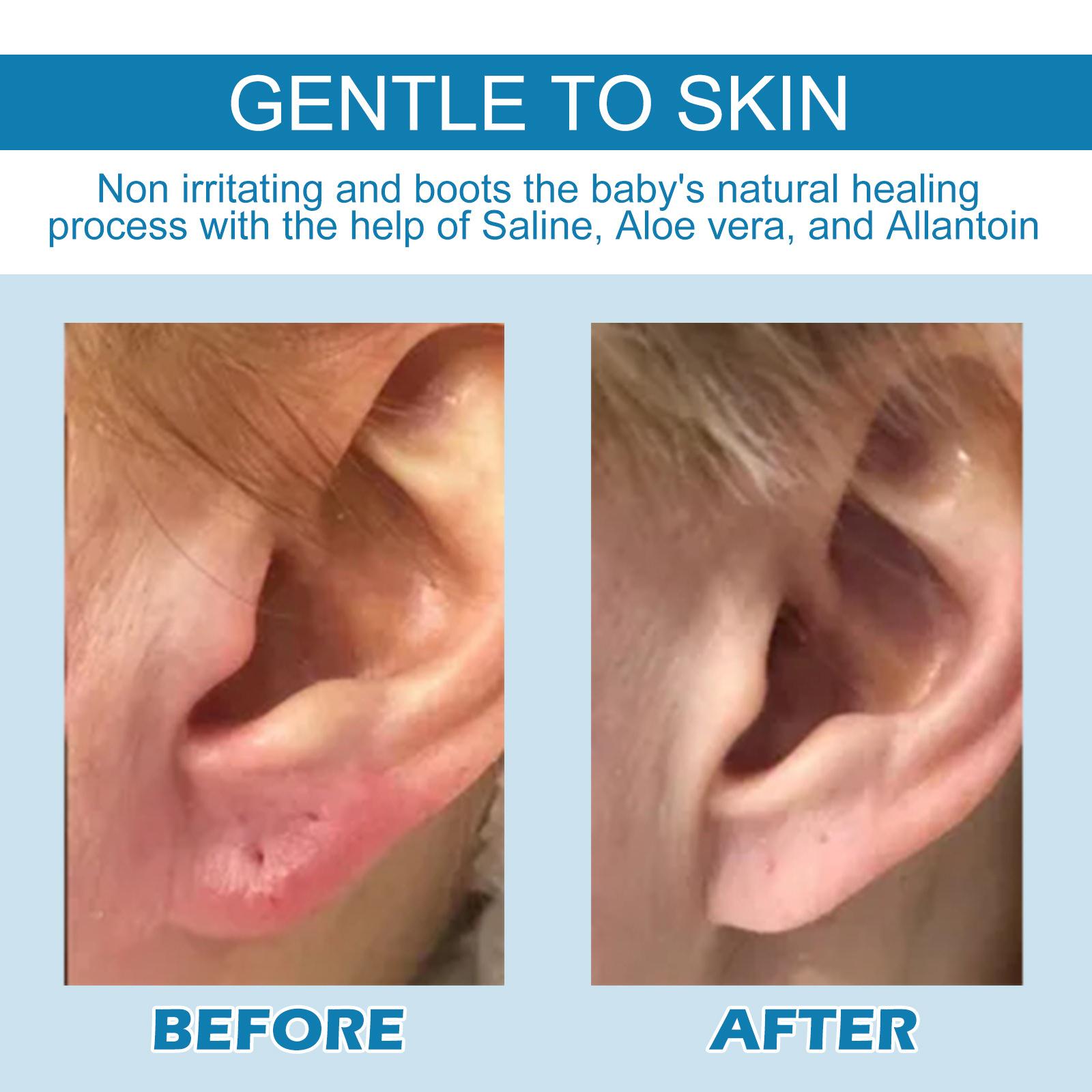 EELHOE 30ml Piercing Relief Treatment Drops Aftercare Treatment Gentle Soothing Bumps Keloid for Ears Nose Nipples Facial Body Areas