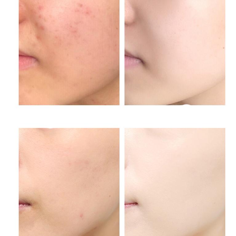 Tinh chất làm trắng IMAGE hexapeptide làm sáng da, dưỡng ẩm, làm mềm da 30ml