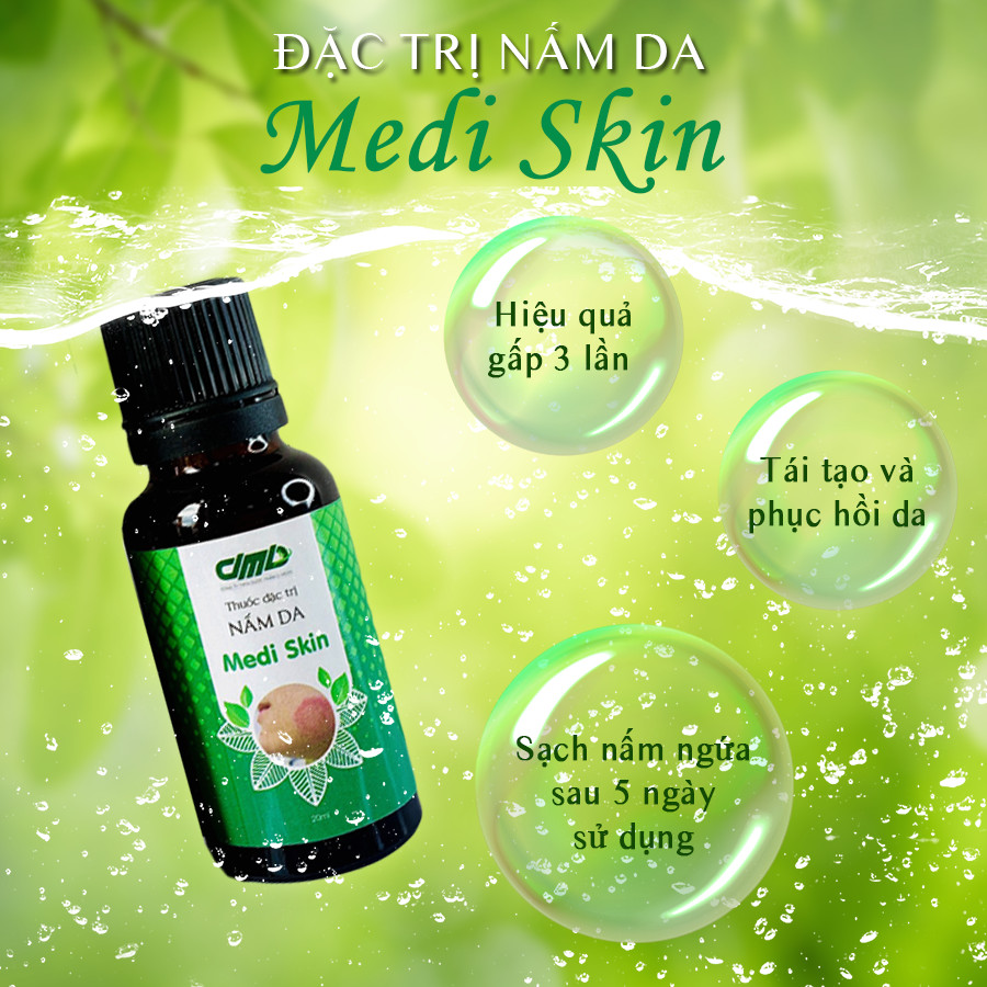 Hỗ trợ trị nấm da Medi Skin Tinh Chất Phục Hồi Giảm Ngứa Rát Vùng Da Do Nấm Từ Thảo Dược 20ml