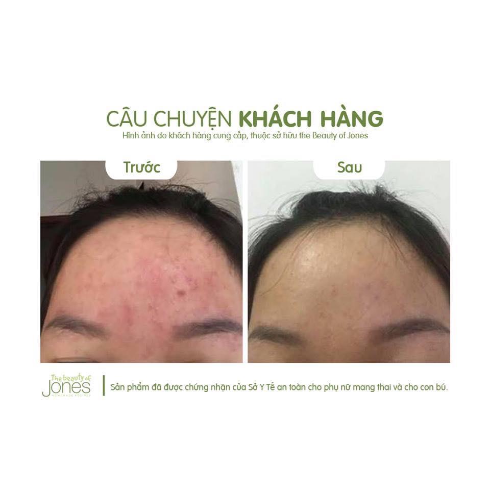 Bộ đôi làm sạch và chống nắng cho da dầu The Beauty of Jones