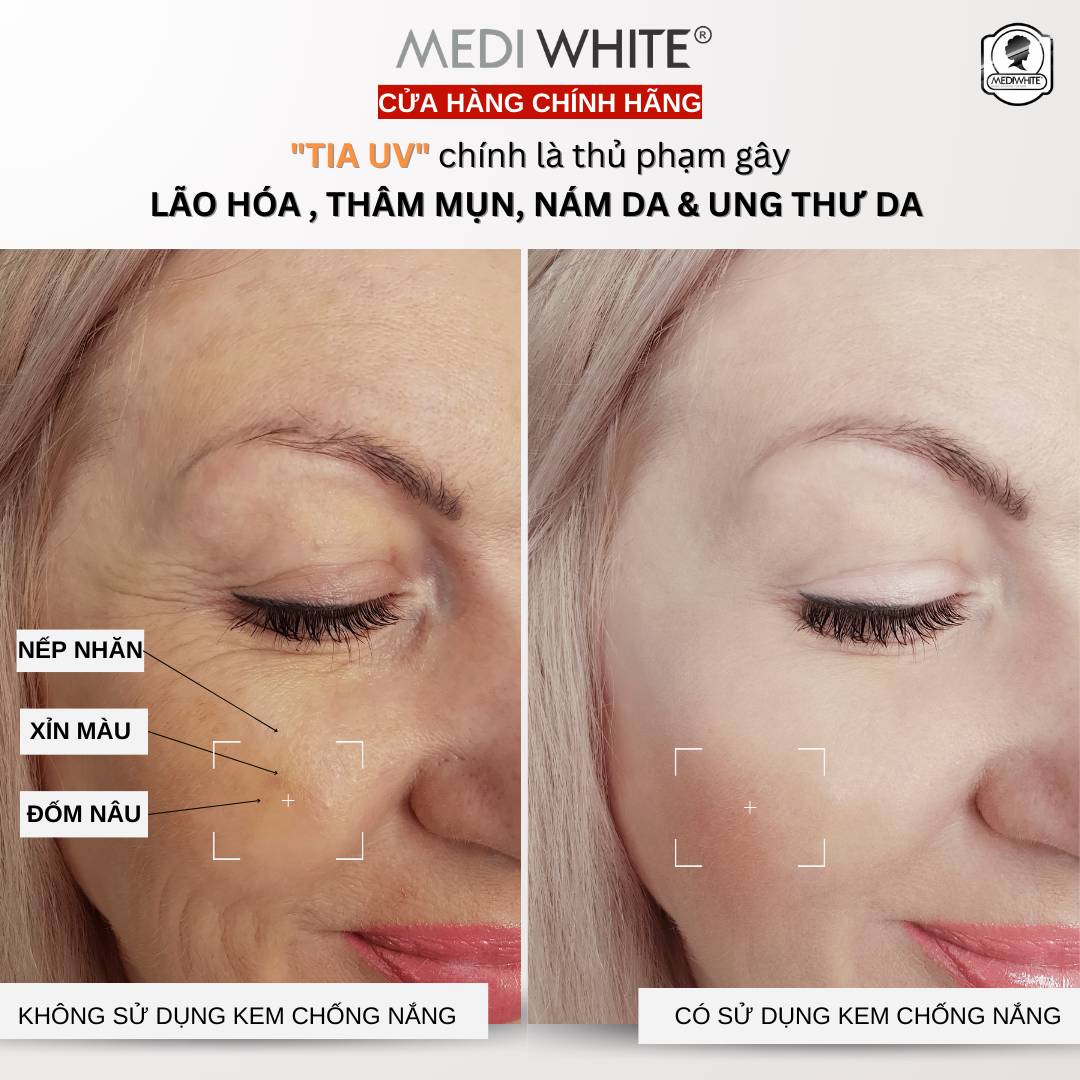 Kem chống nắng nâng tông Medi White mỏng nhẹ bảo vệ da khỏi kích ứng ngừa nám da và tàn nhang