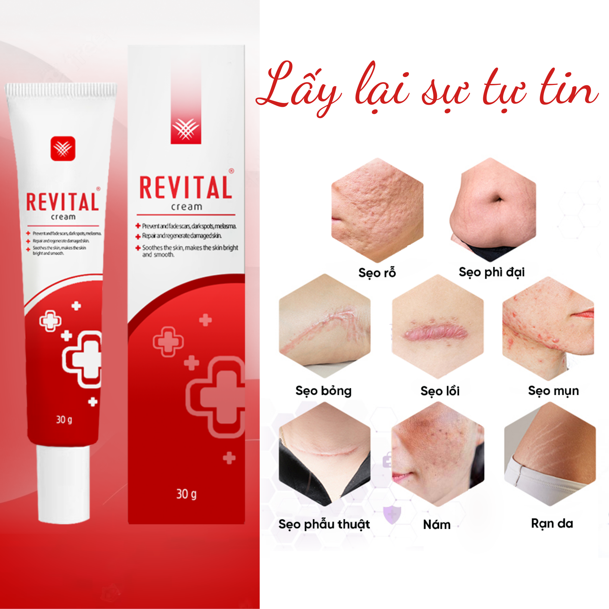 Kem Mờ Sẹo Revital 30g, Làm Trắng Da, Mờ Sẹo, Ngăn Ngừa Lão Hóa Da, Se Khít Lỗ Chân Lông