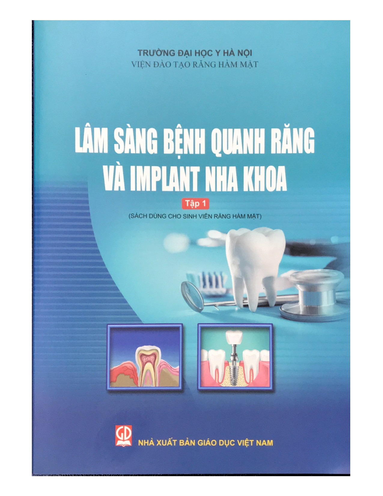Lâm sàng bệnh quanh răng và implant nha khoa - Tập 1