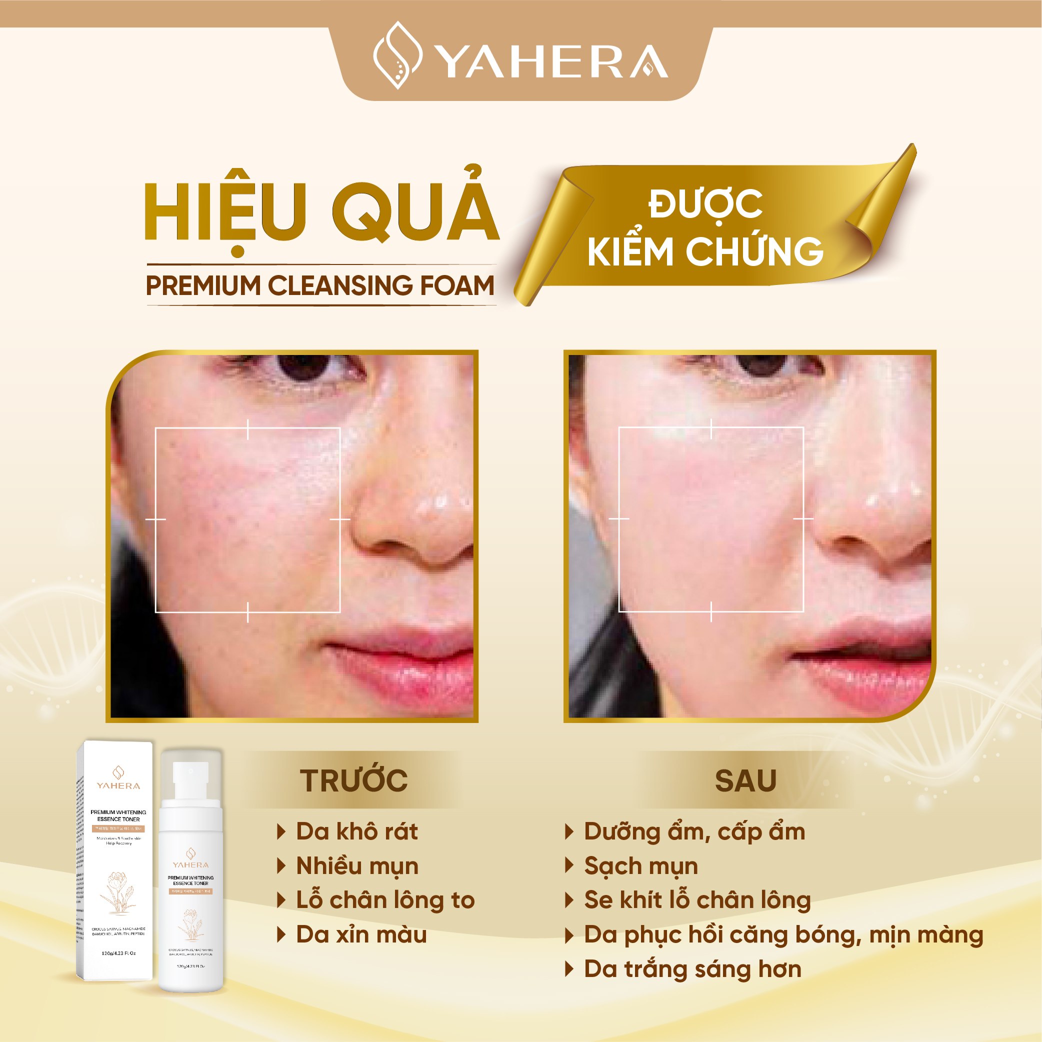 Nước hoa hồng dưỡng trắng da YAHERA Premium Whitening Essence Toner giúp sạch sâu, dưỡng ẩm, cân bằng độ pH da, se khít lỗ chân lông và ngăn ngừa mụn 120g