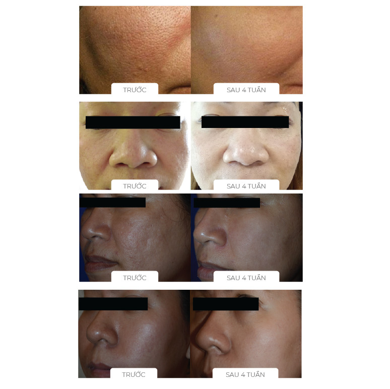 Bộ sản phẩm giúp điều chỉnh và ngăn ngừa các dấu hiệu lão hóa AGE REVERSE SYSTEM COSMEDICAL