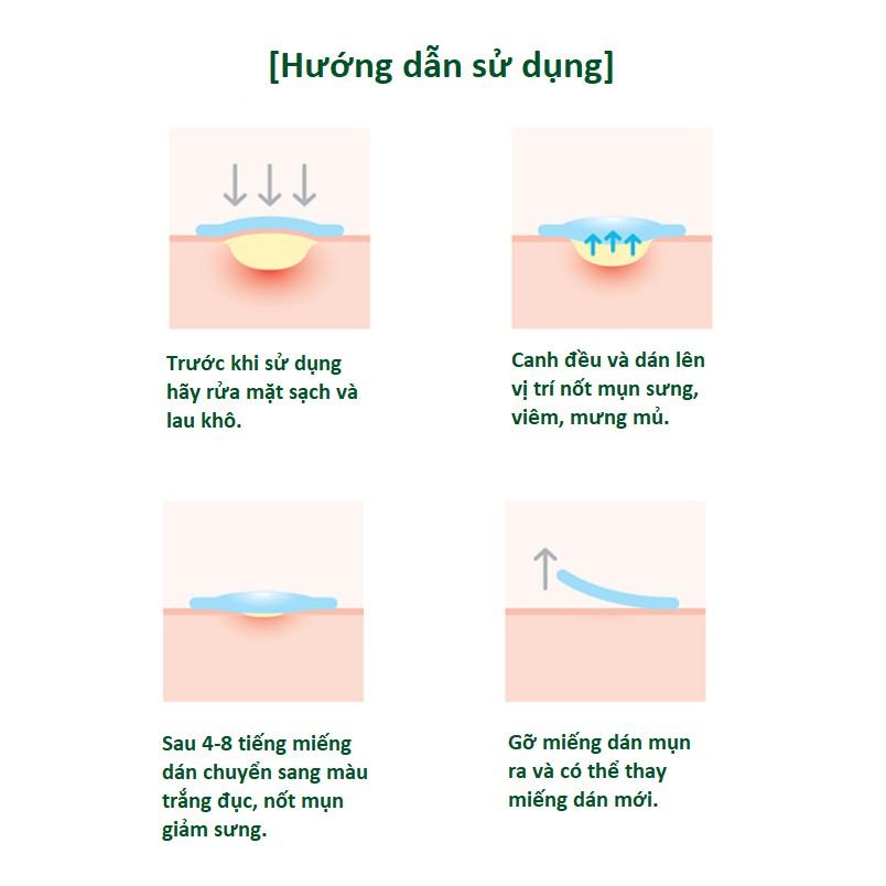 Miếng Dán Mụn Some By Mi Clear Spot Patch (Set 18 miếng)