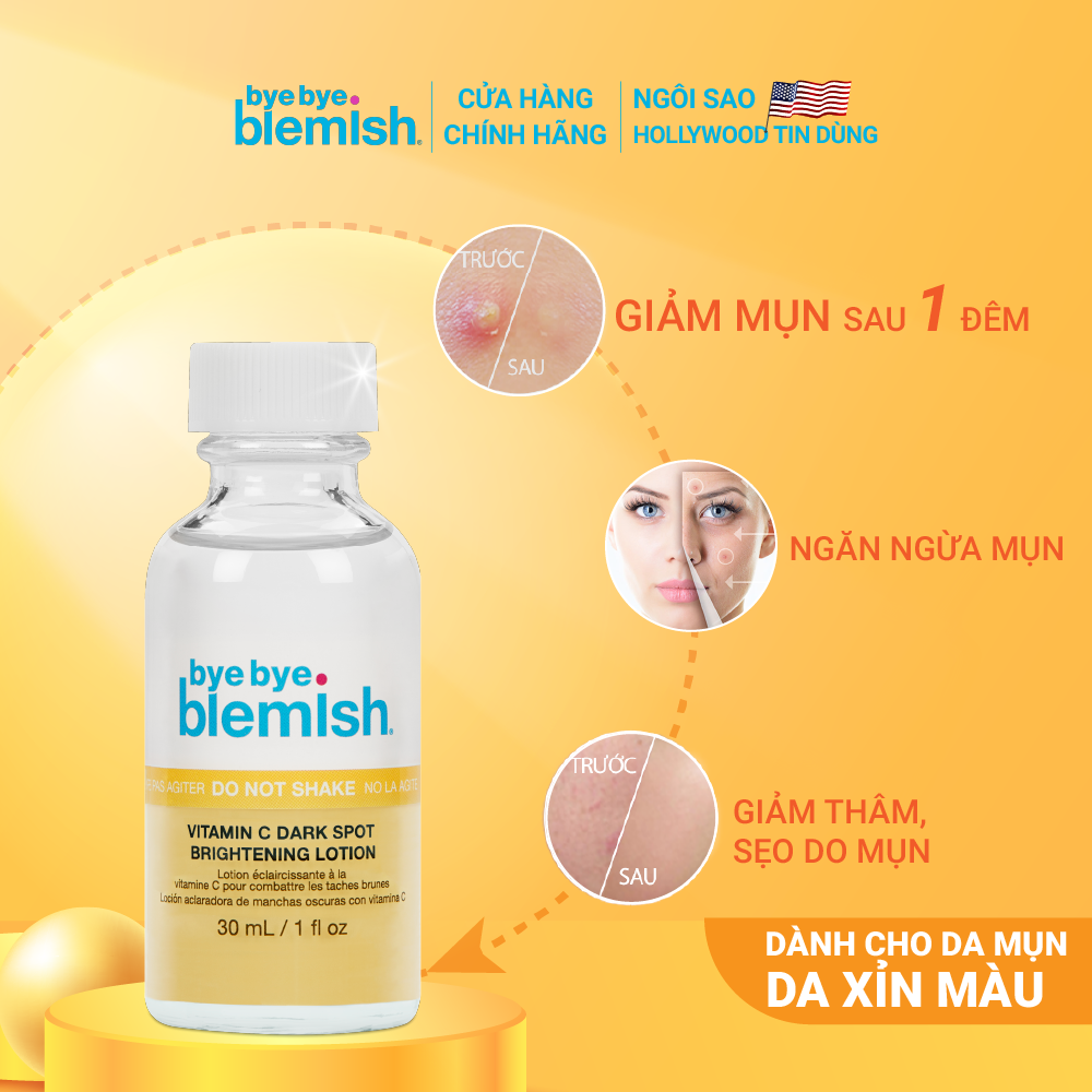 Chấm mụn Vitamin C giảm mụn nhanh sau 1 đêm cho da mụn thâm xỉn màu Bye Bye Blemish Vitamin C Dark Spot Brightening Lotion 30ml