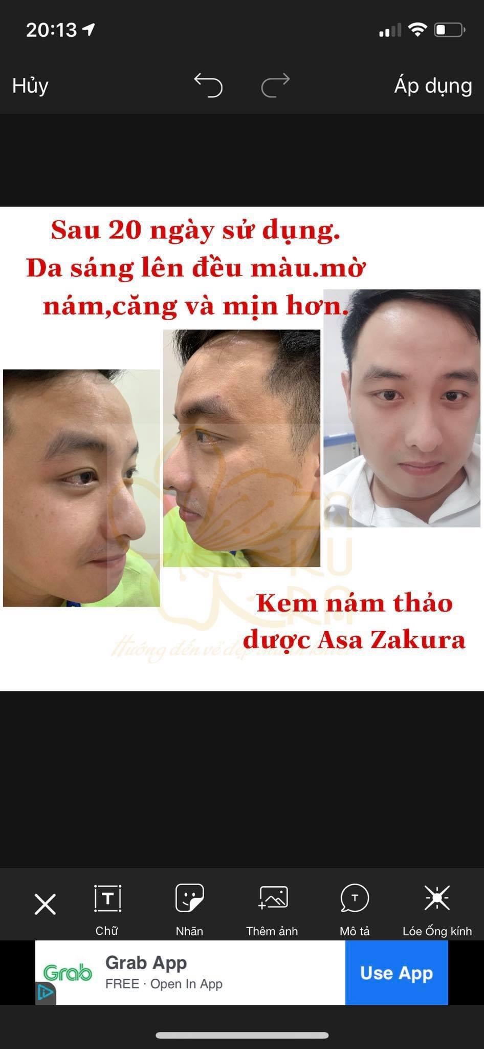 KEM NÁM THẢO DƯỢC ASA ZAKURA