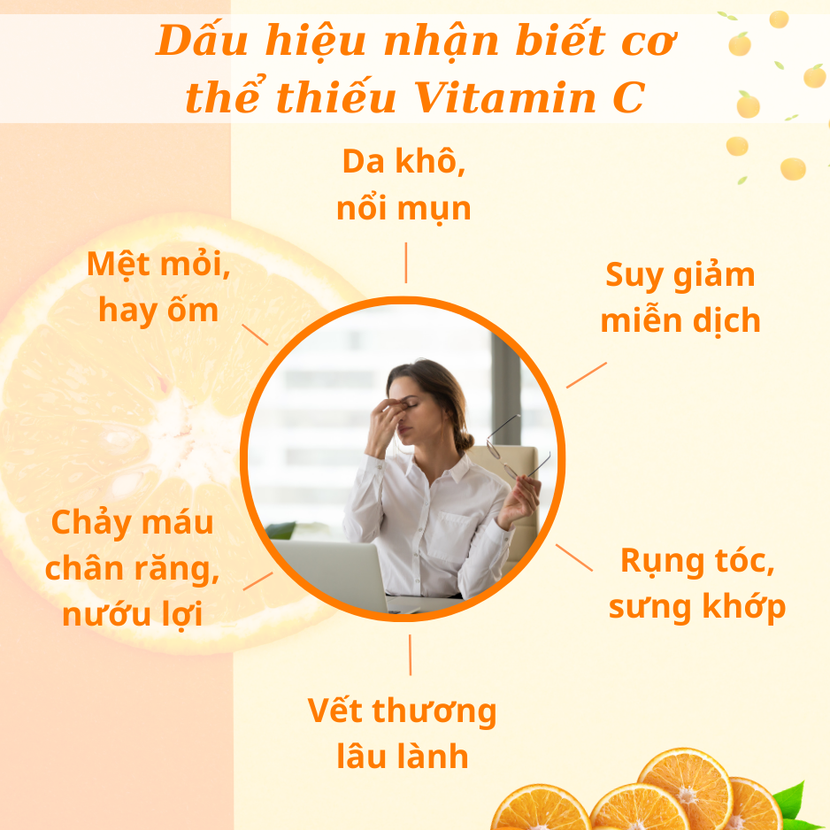 Viên uống Feelex VTM Vitamin C bổ sung vitamin C, sáng da, mờ thâm, tăng cường đề kháng - gói 60 viên