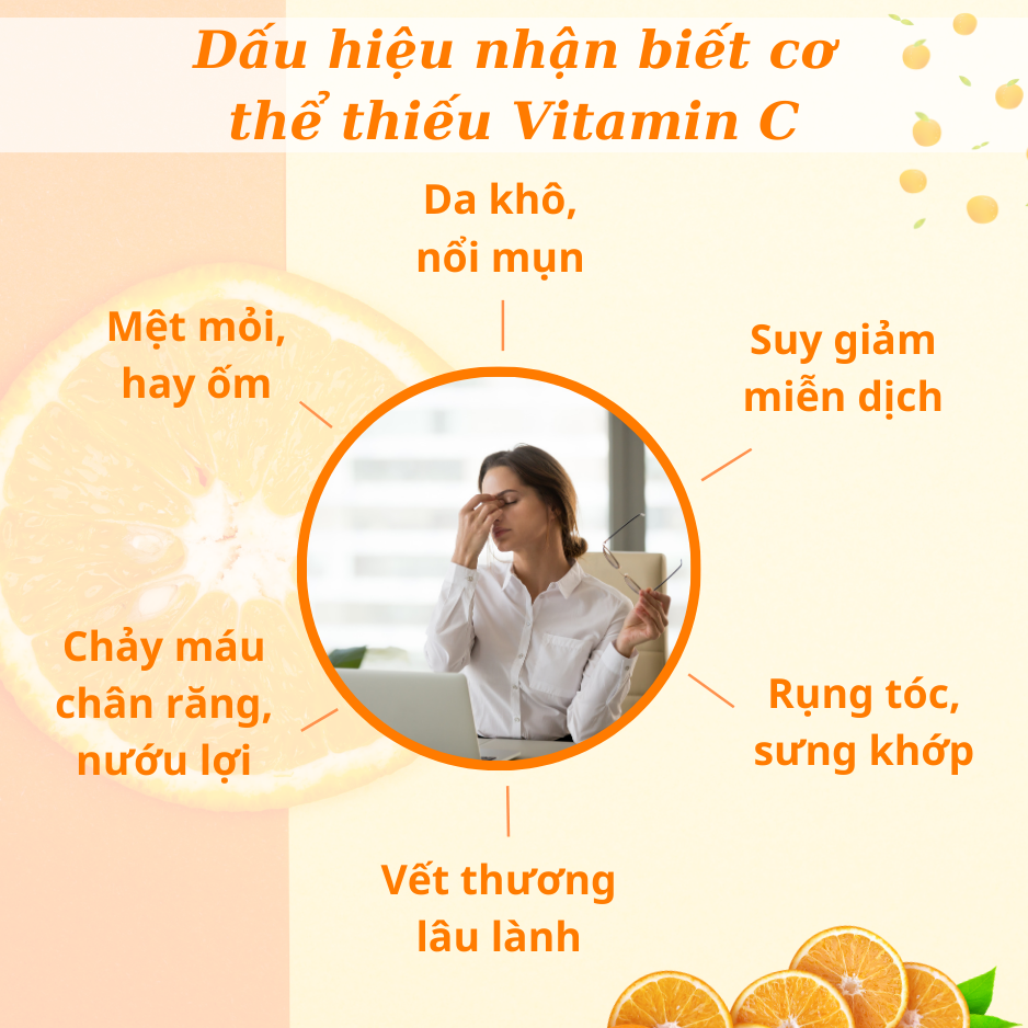 Viên uống Feelex VTM Vitamin C bổ sung vitamin C, sáng da, mờ thâm, tăng cường đề kháng - gói 60 viên(30 ngày)