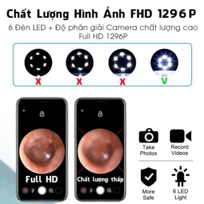 [KoSuyTu] Dụng Cụ Lấy Ráy Tai Có Camera Nội Soi Full HD – Kết Nối Điện Thoại - Đèn LED Chiếu Sáng, An Toàn Cho Cả Gia Đình