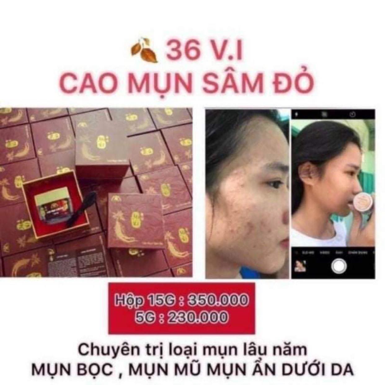 Cao mụn sâm đỏ 36vị 15g mua 1 tặng 1 gel hút mụn tro núi lửa