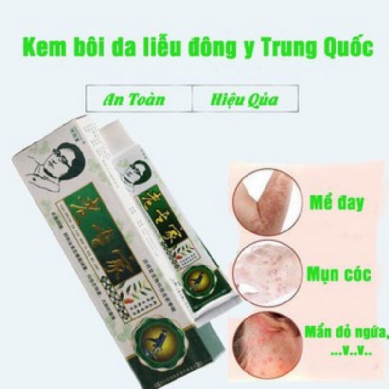 Kem bôi ngoài da khỏi hết ngứa nấm á sừng, hắc lào viêm da vảy nến, công trùng đốt nước ăn chân tay  Cực Hiệu Quả.