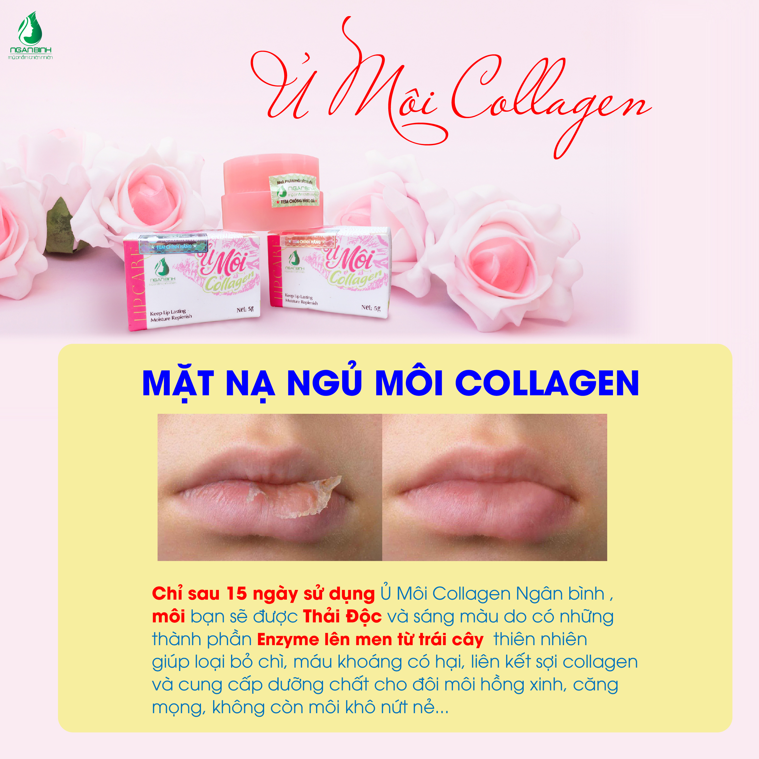 Ủ MÔI COLLAGEN