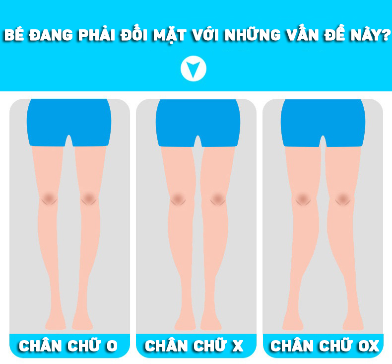 Đai Chỉnh Hình Thẳng Chân Vòng Kiềng Dành Cho Trẻ Em- Hàng Nhập Khẩu
