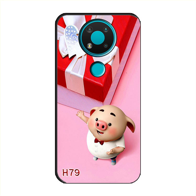 Ốp Dẻo Dành Cho NOKIA 3.4