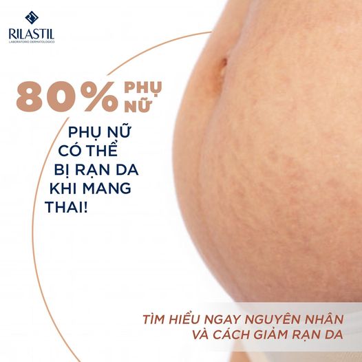 Tinh chất ngăn ngừa và giảm rạn da Rilastil Stretch Marks Ampoules 10 ống x 5ml