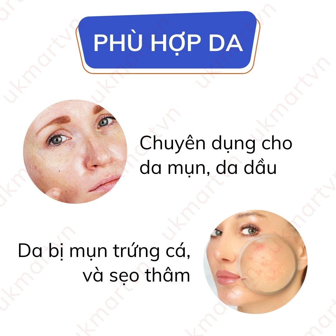 Sữa Rửa Mặt Acnacid Elfa Kháng Khuẩn 150ml
