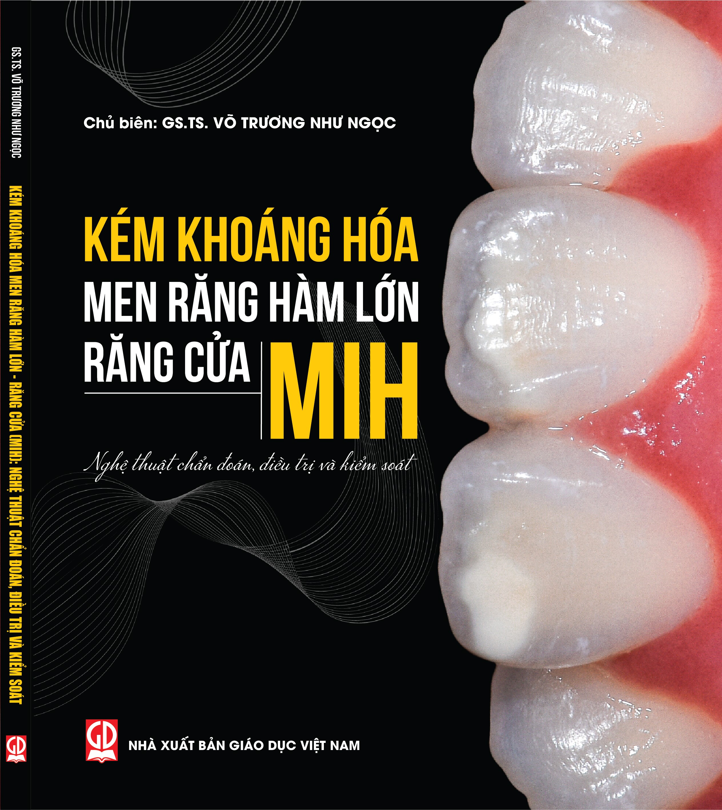 Kém khoáng hóa men răng hàm lớn – răng cửa (MIH) : Nghệ thuật chẩn đoán, ĐT  và kiểm soát