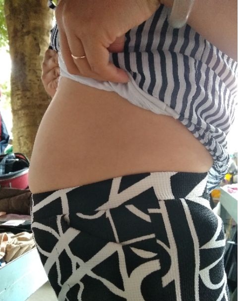 Gen nịt bụng thông hơi dùng định hình eo