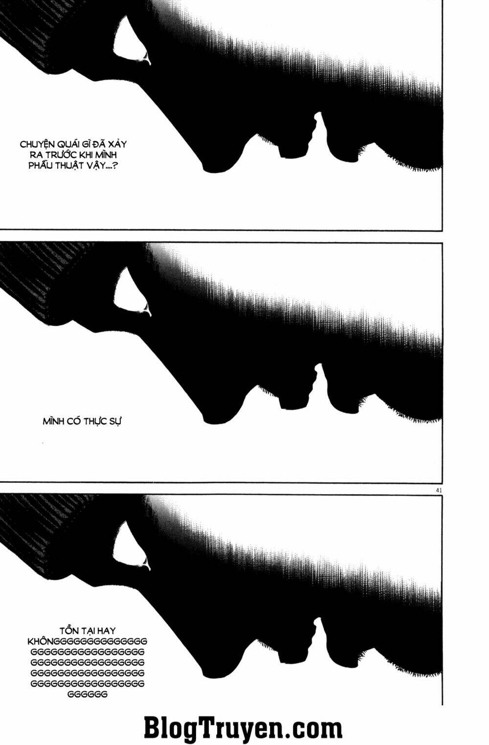 homunculus chapter 93 12