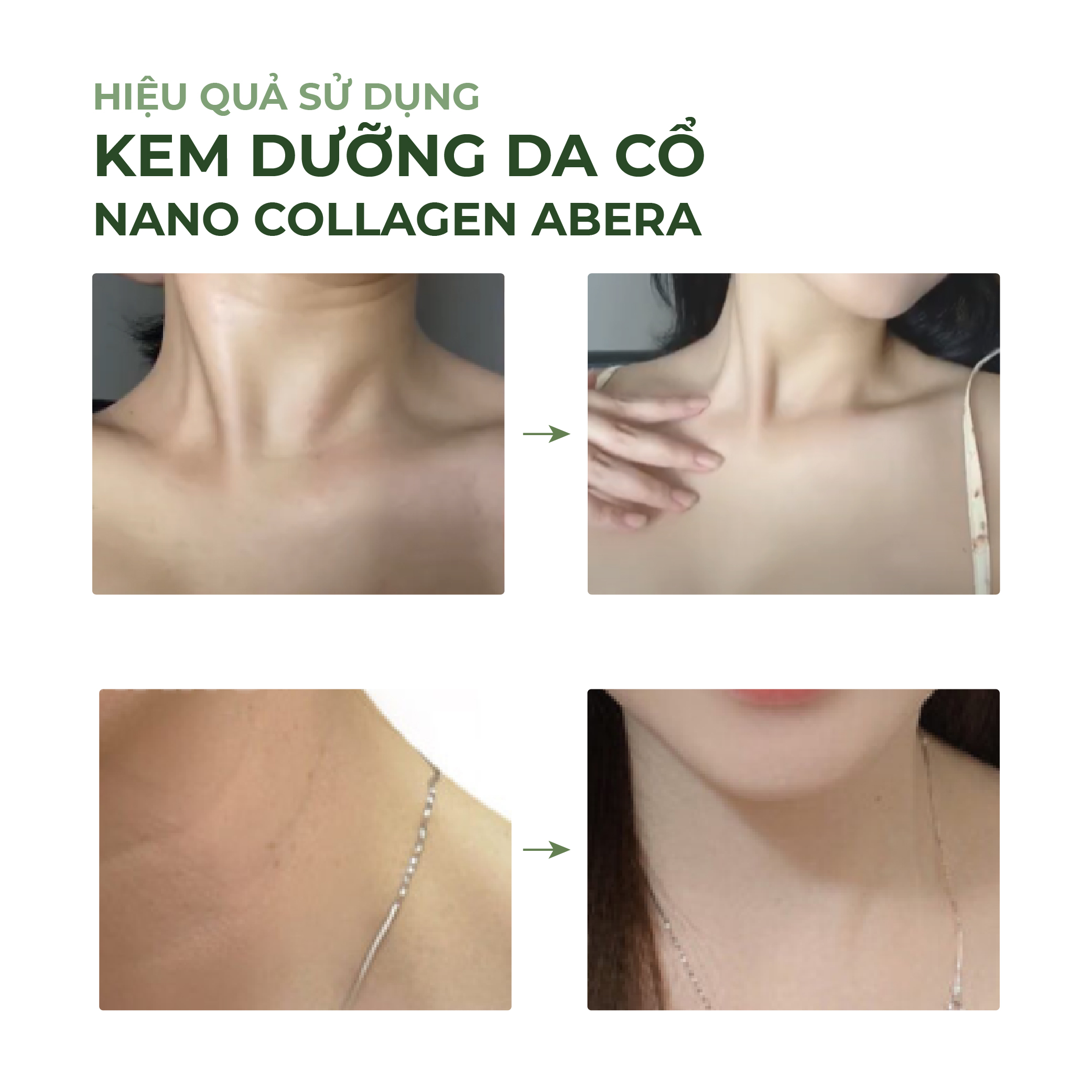 [Combo 2] Kem dưỡng da cổ Loka Nano Abera Chăm Sóc, Phục Hồi Da Cổ, Lấy Lại Sự Đàn Hồi Của Tuổi Xuân