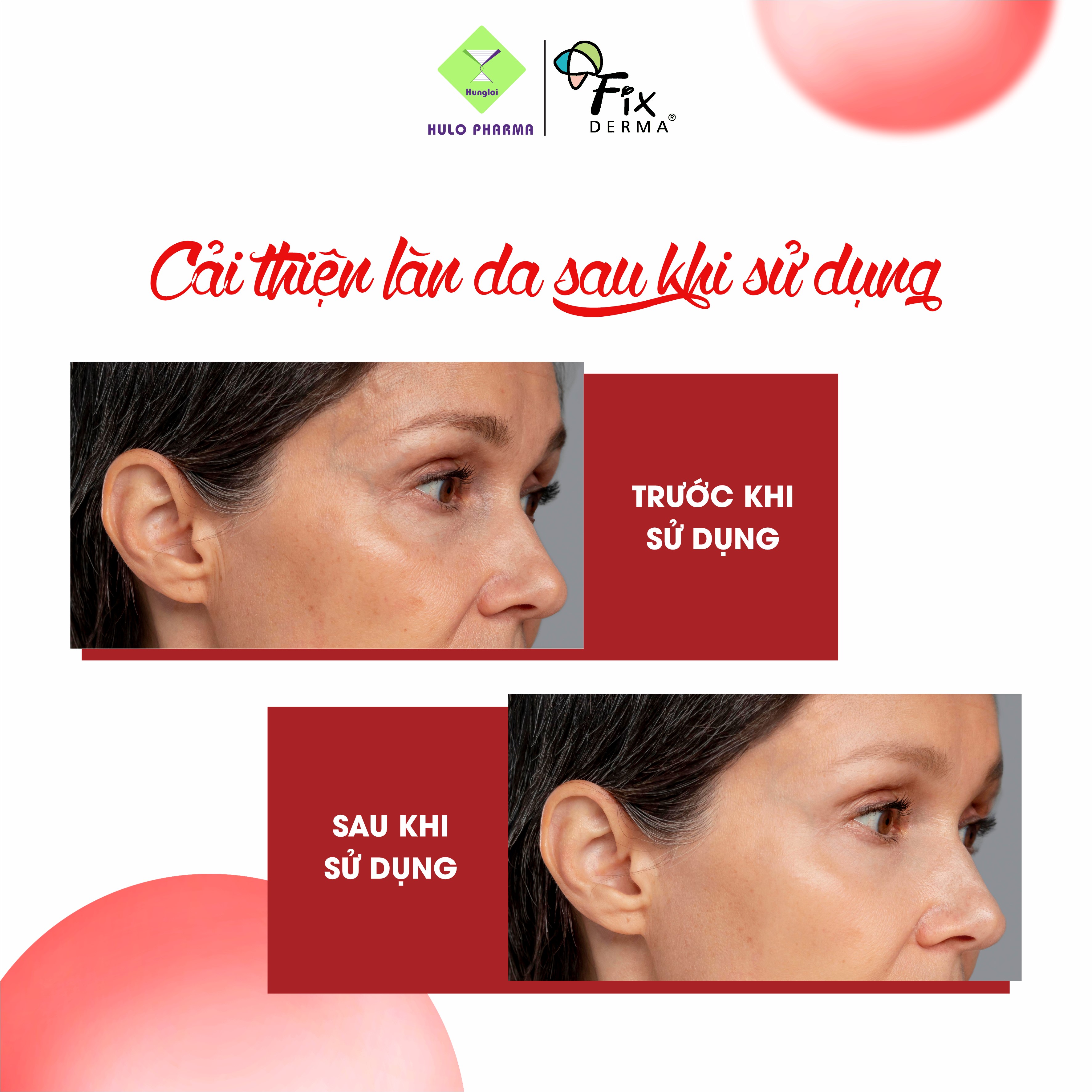 Sữa rửa mặt Fixderma Strawberry Face Wash (60g)