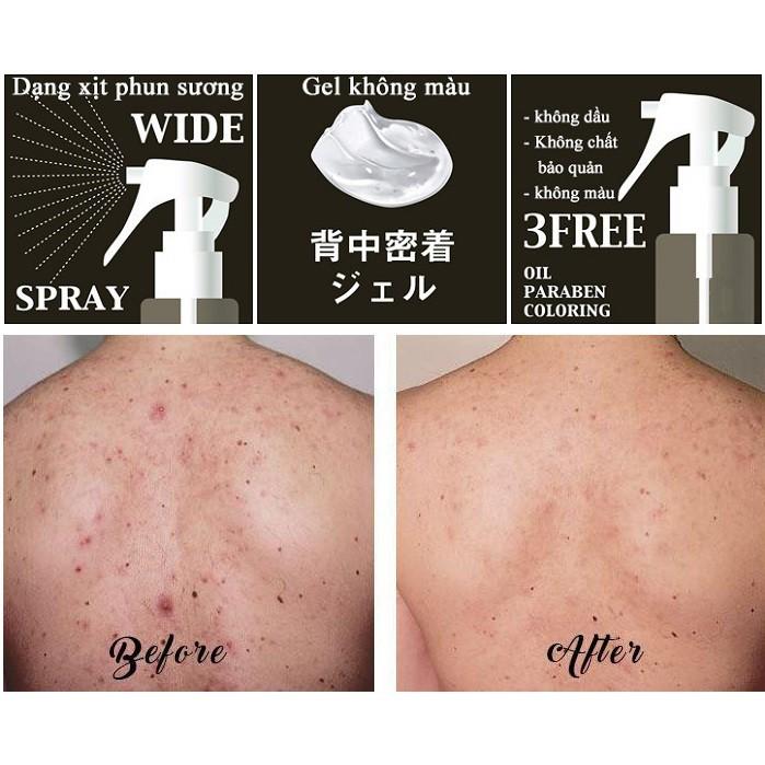 Xịt Giảm Mụn Lưng Giảm Vết Thâm, Kiềm Dầu PELICAN Medicated For Back Gel Mist 100ml