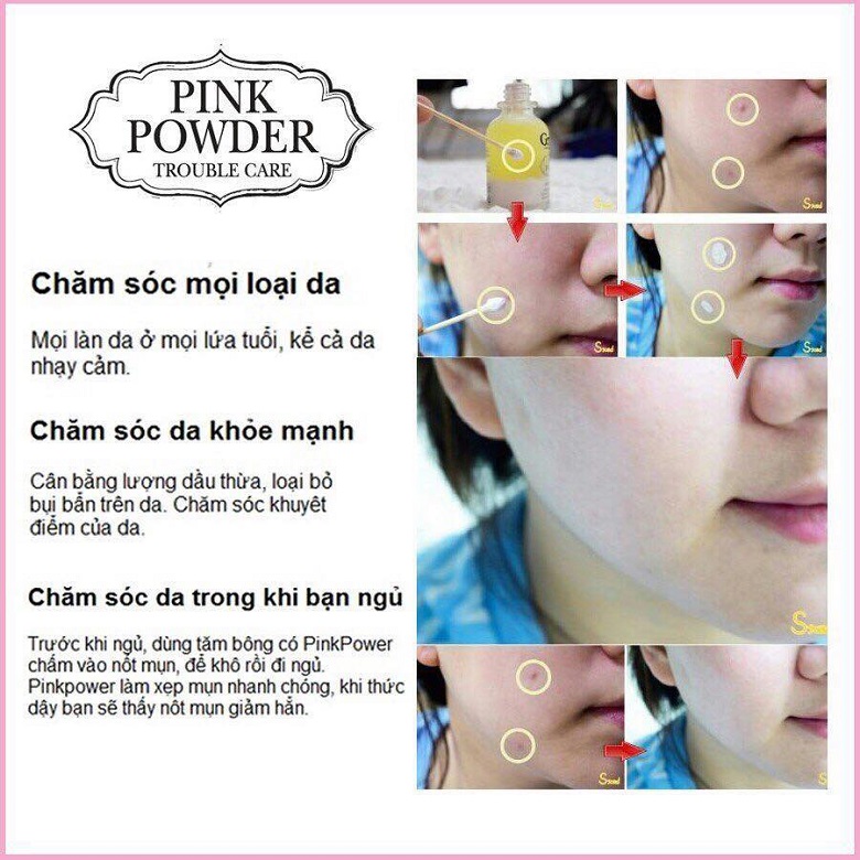 Tinh Dầu Hỗ Trợ Giảm Mụn Xóa Vết Thâm Grinif Pink Powder (40g)