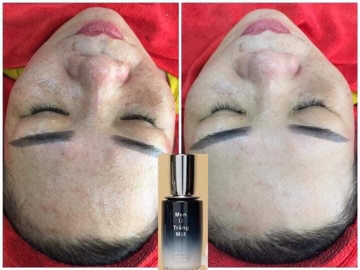 Men Ủ Trắng Mặt DR CELL 50g nhả nắng làm trắng da hỗ trợ mờ thâm nám - Hàng Chính Hãng