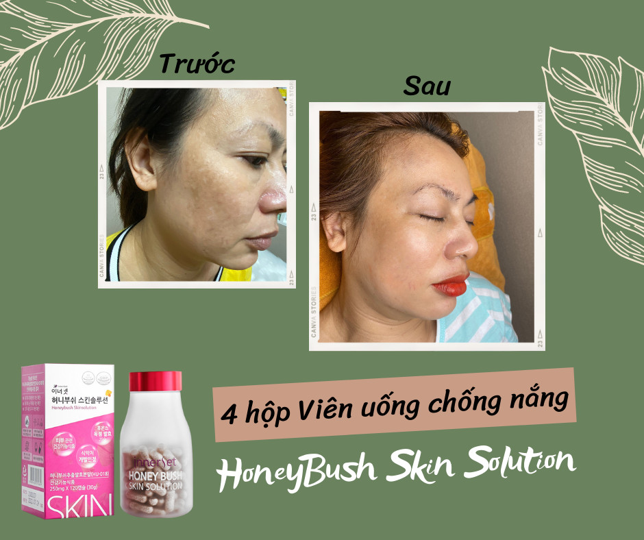 Viên uống chống nắng HoneyBush Skin Solution Hàn Quốc 120 viên