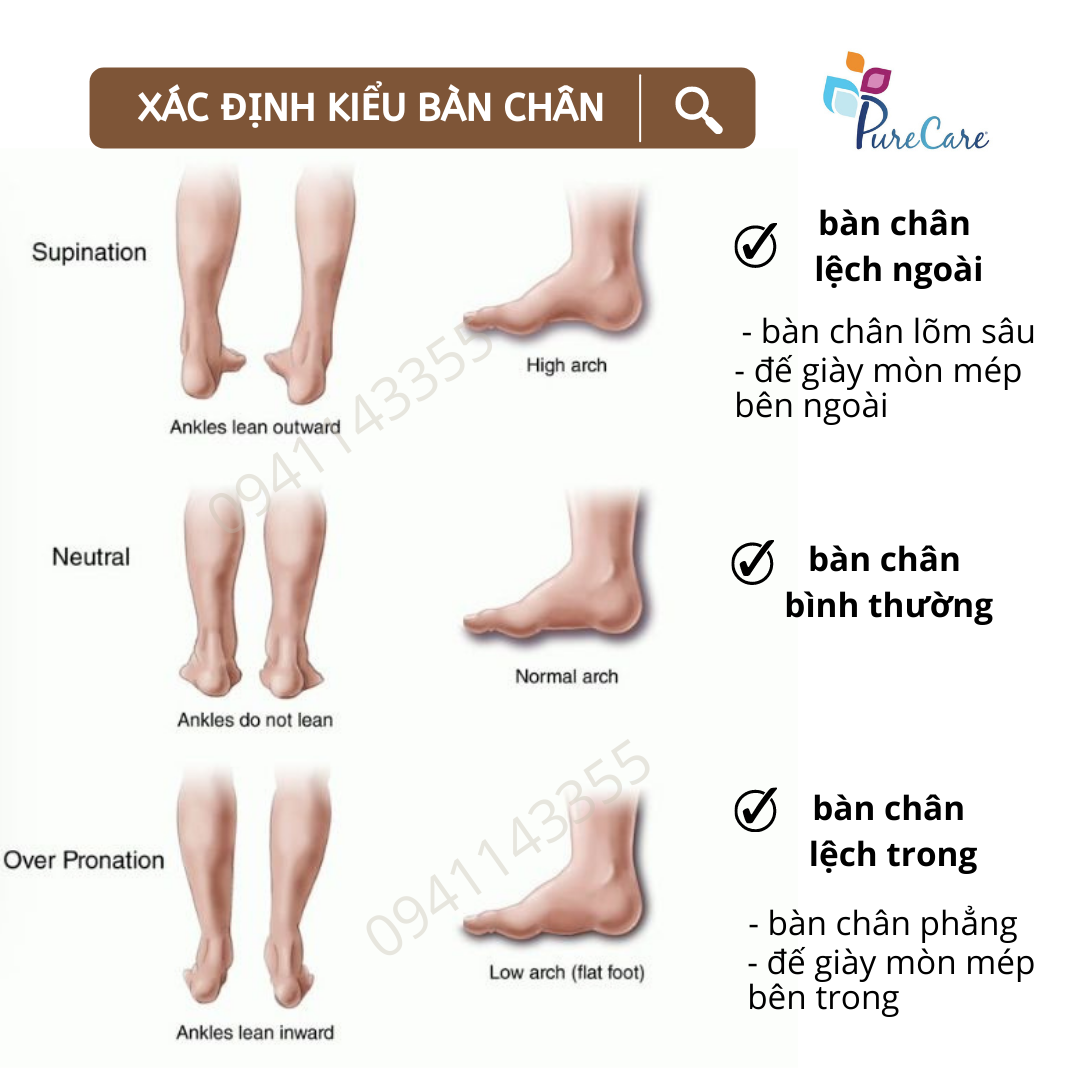 Lót cho người “lật mắt cá chân”, chỉnh khớp bàn chân, chân vòng kiềng, chân X/O, đau đầu gối, BỘ 2 CÁI