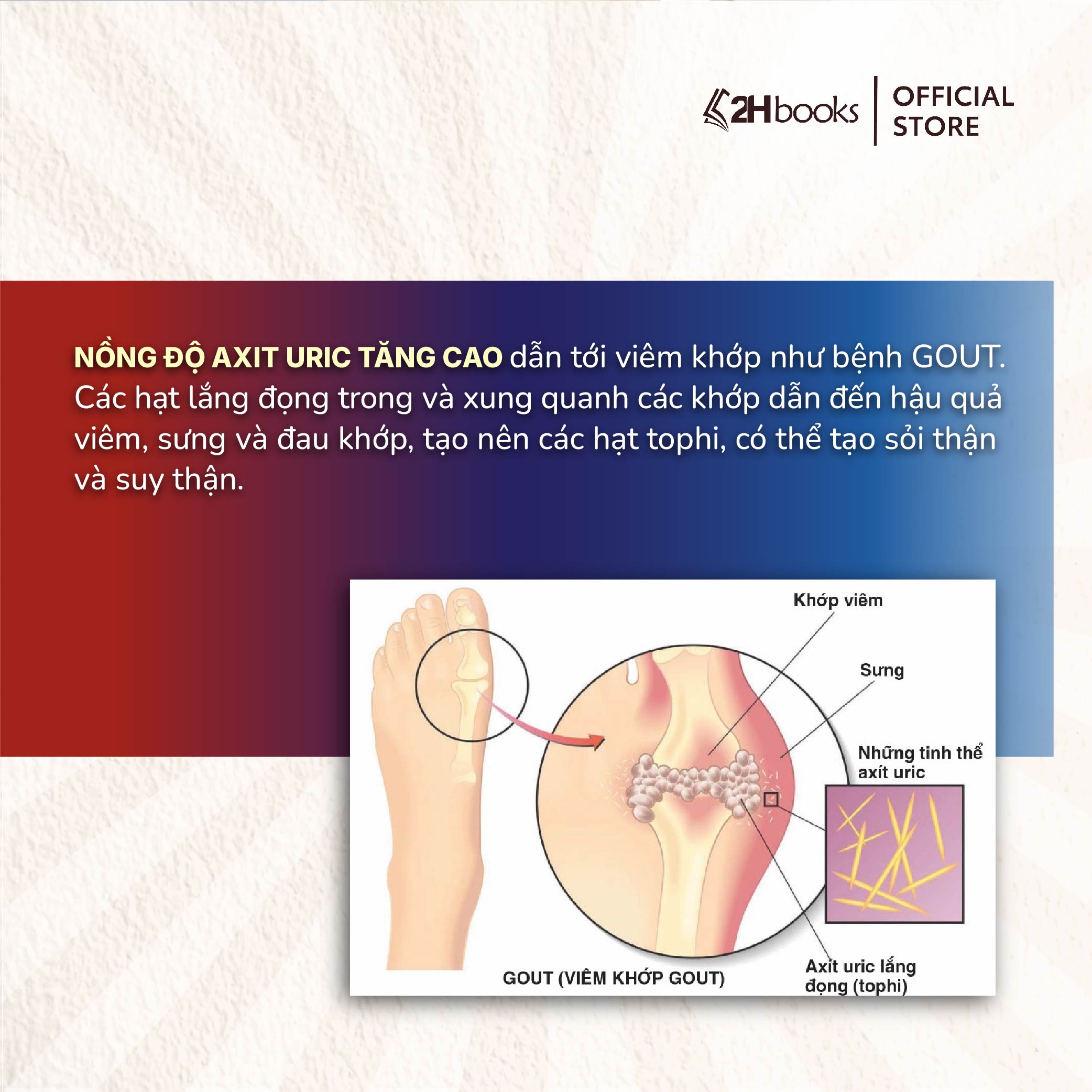 Sách- Chỉ Tại Axit Uric (Xuất Bản 2024)- 2HBooks