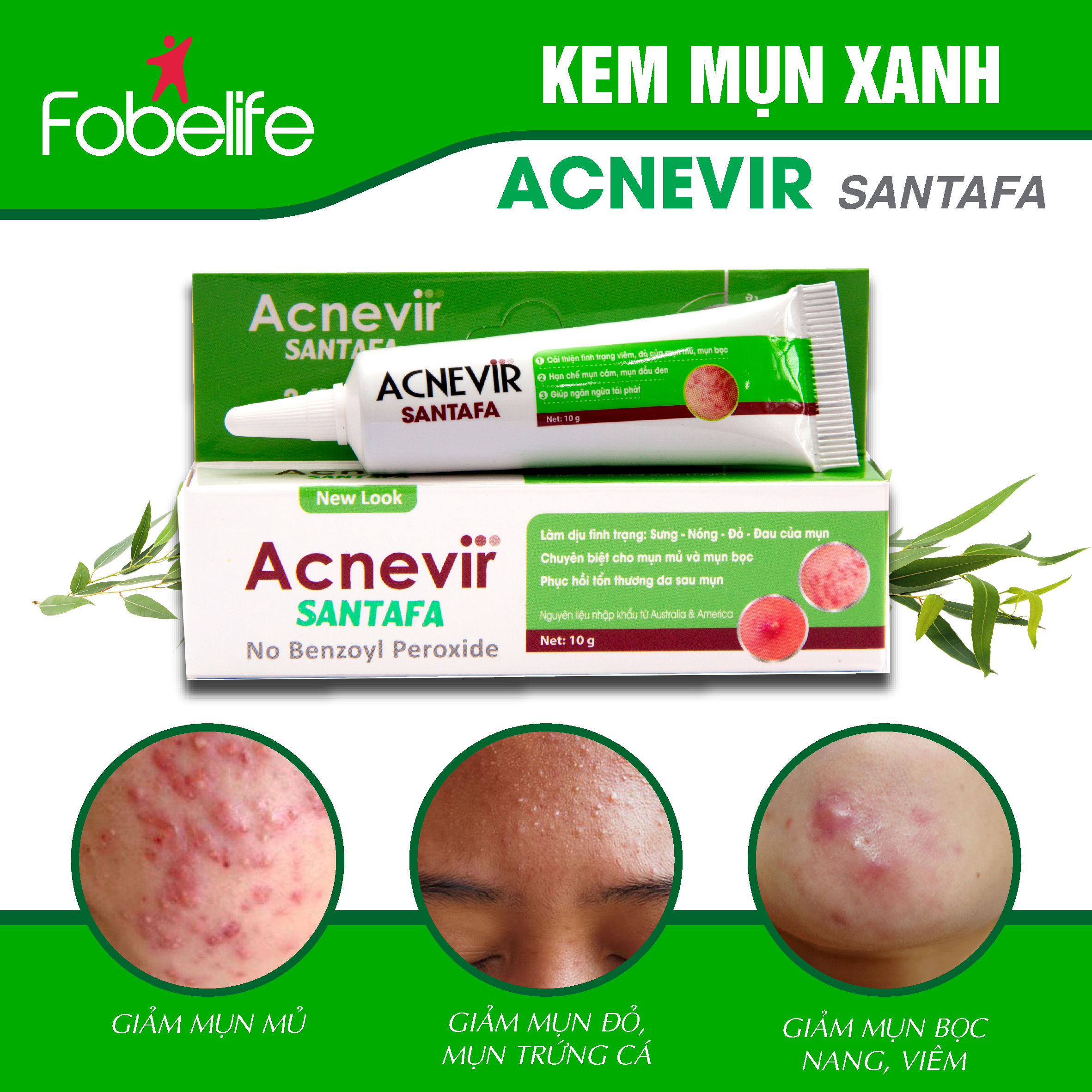 Hình ảnh Kem Hỗ Trợ Giảm Mụn Mủ Mụn Viêm Mụn Bọc Acnevir Santafa xanh ( Tuýp 10gr )